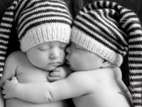 Orang Tua Bayi Kembar Siam Kesulitan Biaya Operasi Pemisahan Bayi Tersebut